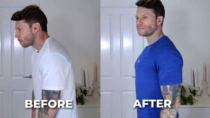 Poor posture vs good posture